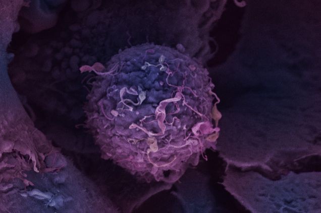 癌症生物标志物